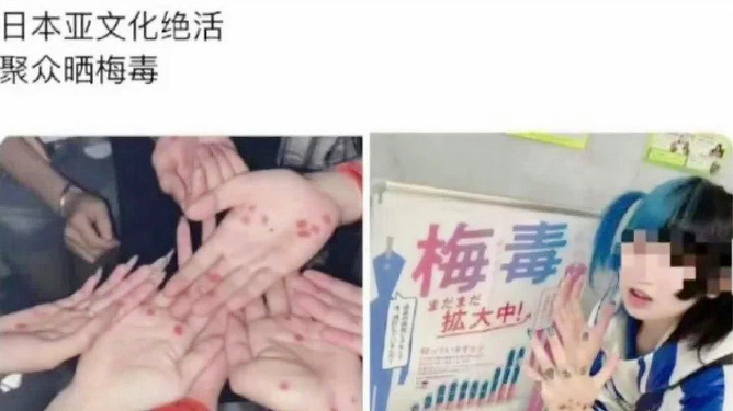 日本梅毒病例激增创纪录，挑战中的自信之路